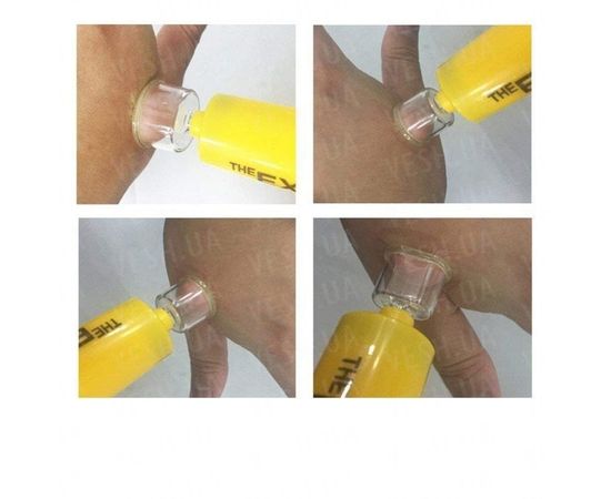Экстрактор яда - набор первой помощи при укусах змей Sawyer extractor pump kit, фото 5 Экстрактор яда - набор первой помощи при укусах змей Sawyer extractor pump kit, фото 5