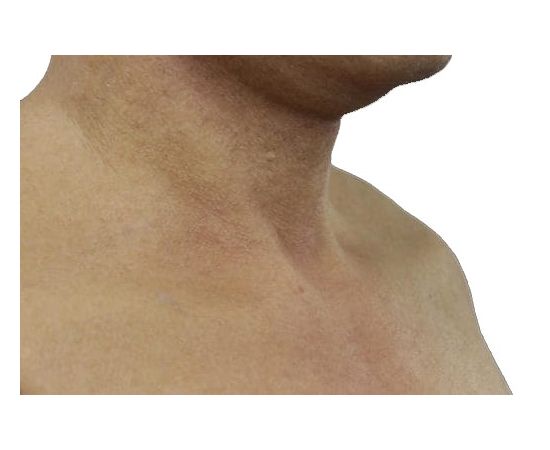 Реалистичная Маска &quot;Мартин&quot;, фото 7