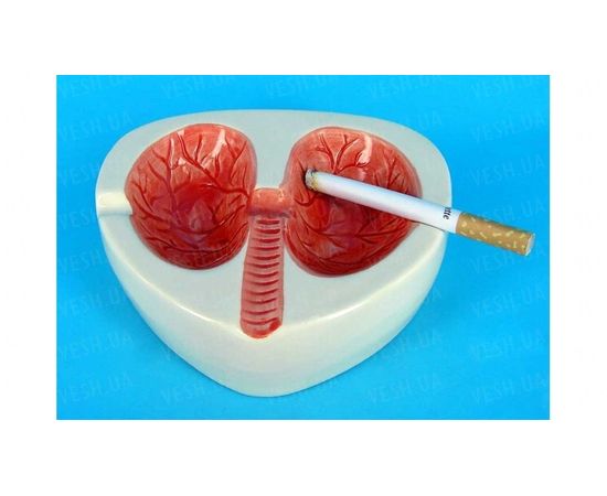 Товар распродан - Пепельница легкие курильщика - Пепельницы, фото 1